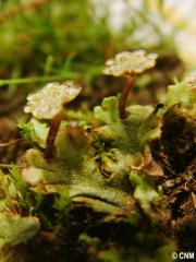 bf_imageHepatica_sp2.jpg